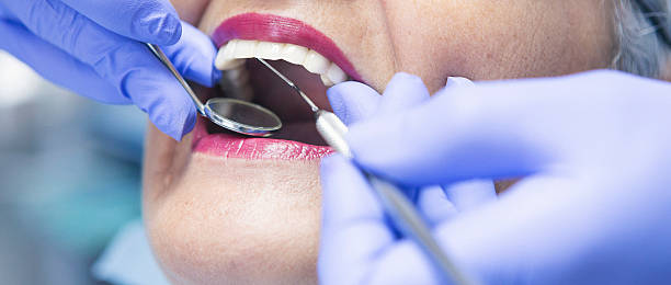 Best Emergency Treatment for Toothache in Olathe, KS